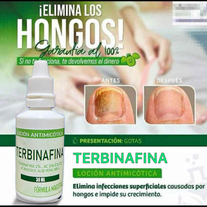 TERBINAFINA-ELIMINA LOS HONGOS DE LAS UÑAS